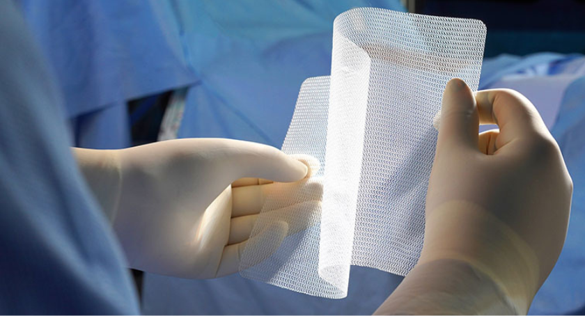 BD Marks Hernia Mesh Milestone, Updates PREVENT Trial Enrollment